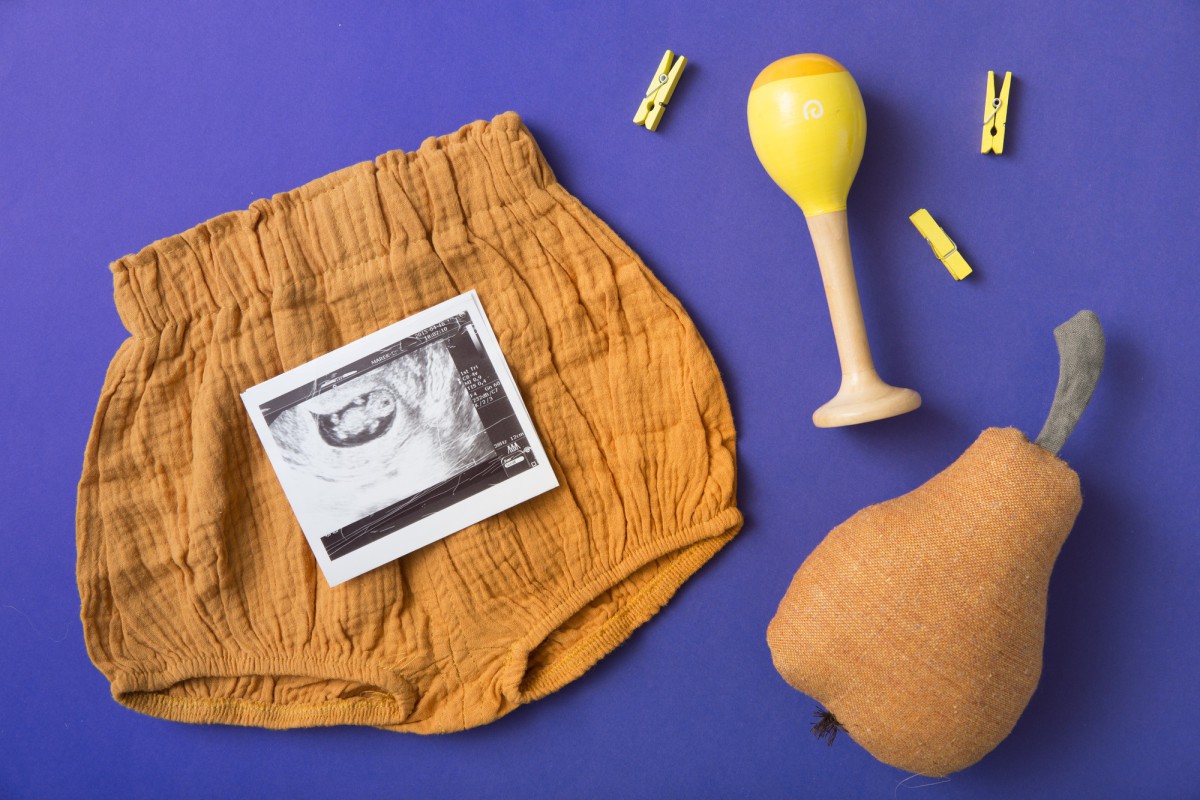 Синдром беспокойных ног у беременных: как облегчить состояние