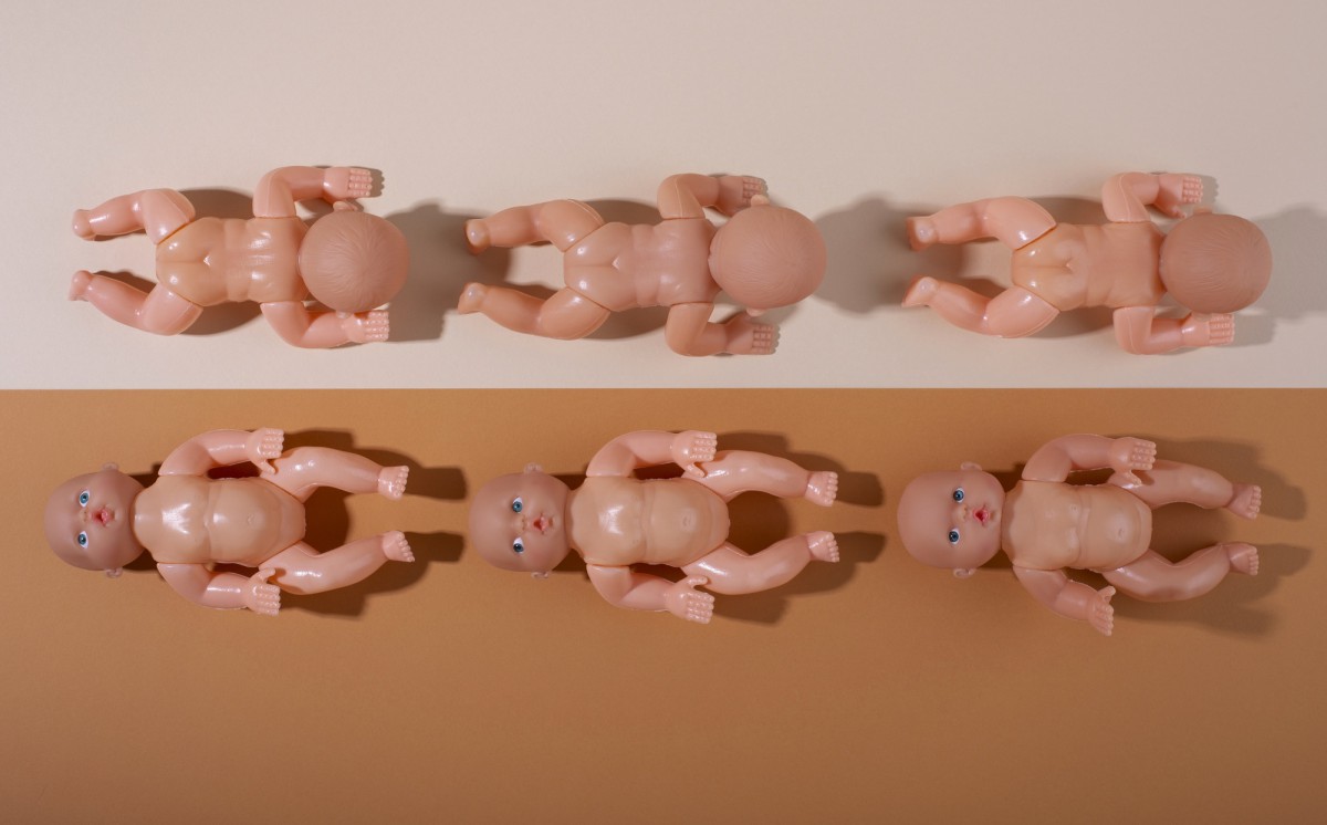 Искусственное родовозбуждение: причины, методы и противопоказания