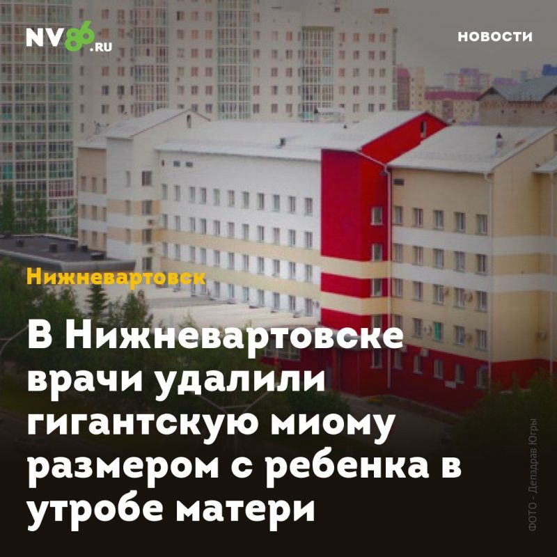 В Нижневартовске врачи удалили гигантскую миому размером с ребенка в утробе матери