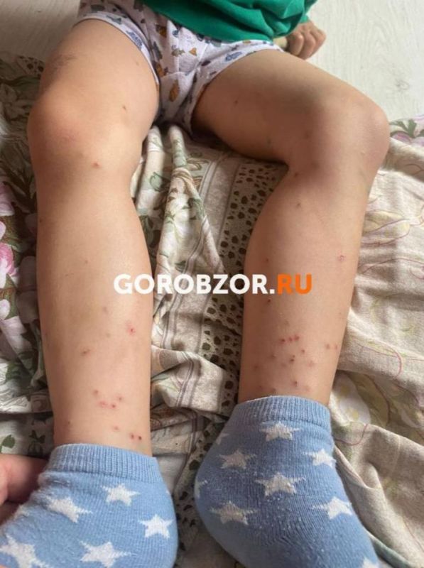 «Детей кусают блохи»: родители требуют проверки уфимского детсада