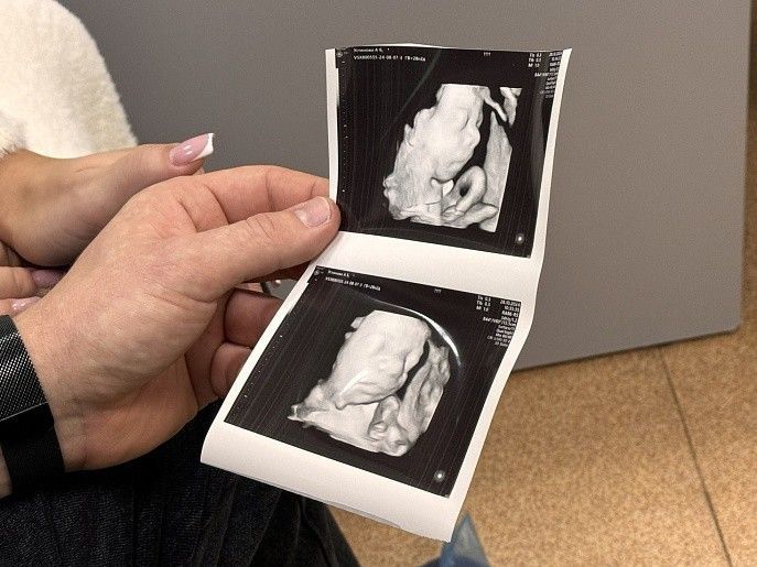 День беременных отметят сегодня в Туле: бесплатные мастер-классы и фотосессии для будущих мам