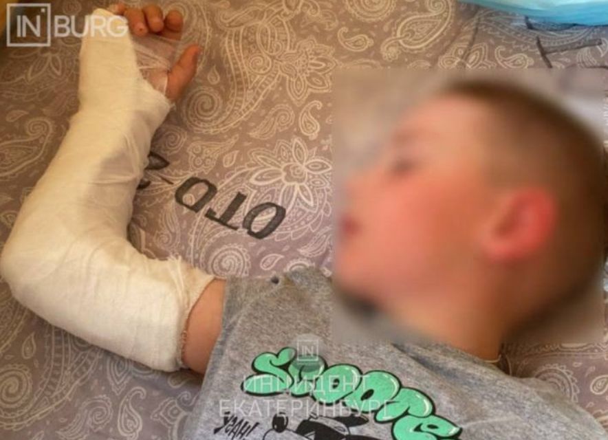 В екатеринбургском детском саду ребенок сломал руку