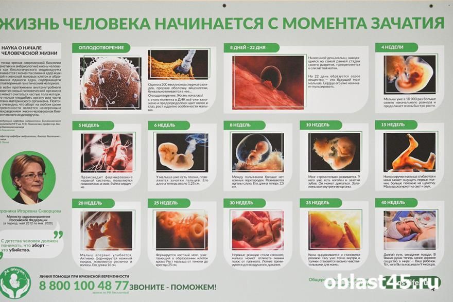 Власти Зауралья предложили правительству РФ пересмотреть расходы на аборты