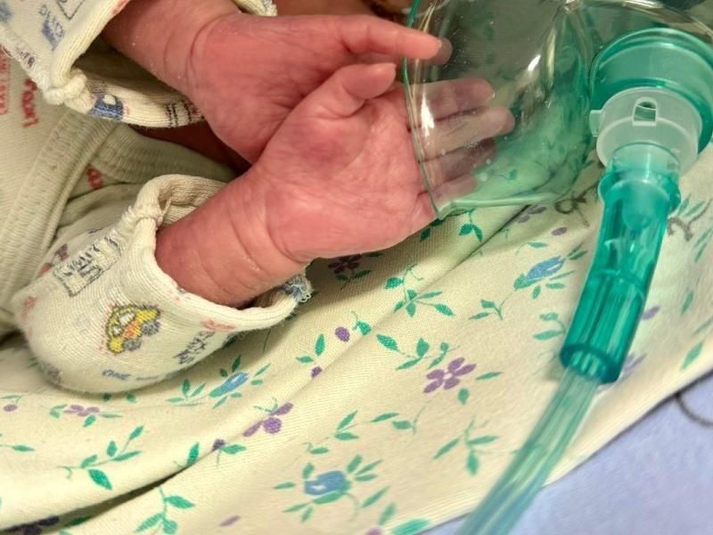 В Рязани рассказали о состоянии младенца, который родился с весом 490 грамм