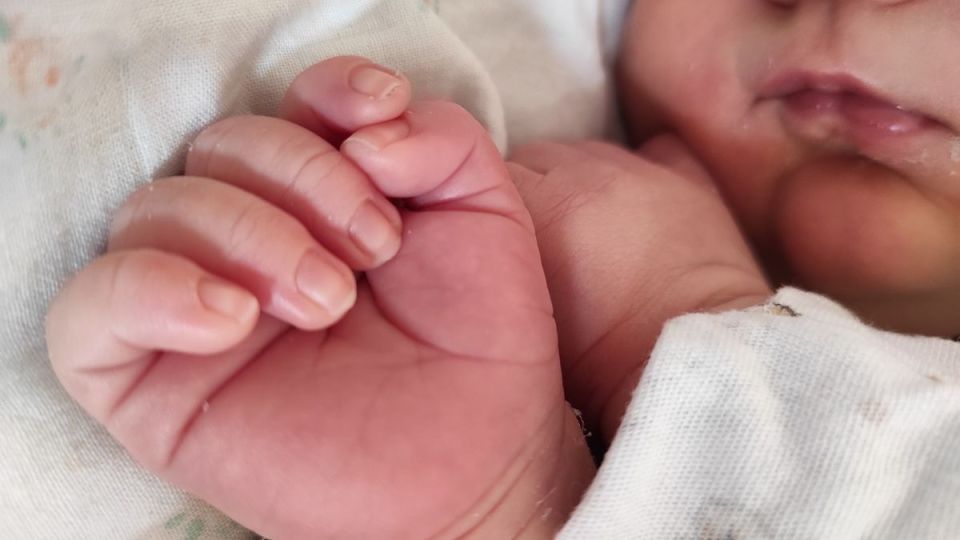 В Калужской области почти вдвое сократилось число рождений детей с синдромом Дауна