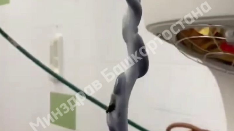 Уфимские врачи приняли роды с пуповиной втрое длиннее нормы