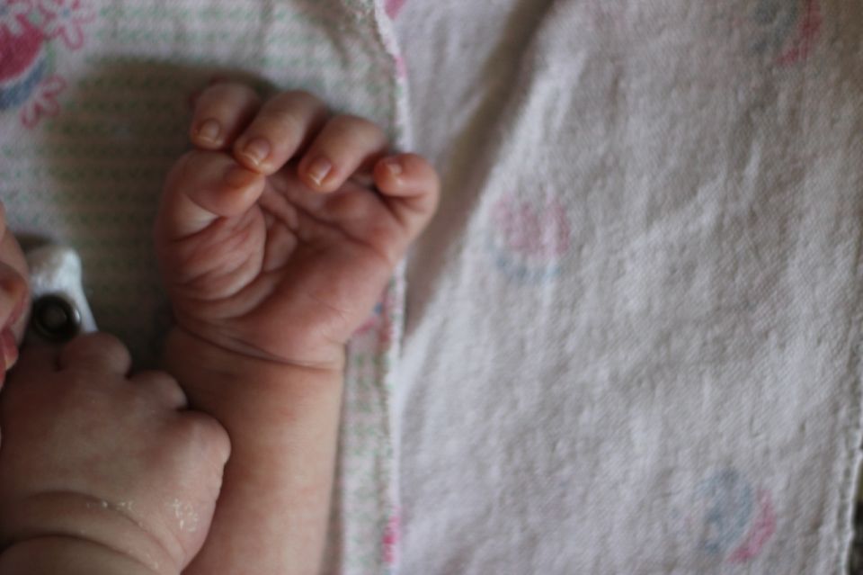 Новгородский врач-неонатолог: если новорожденный стал желтым — это не страшно