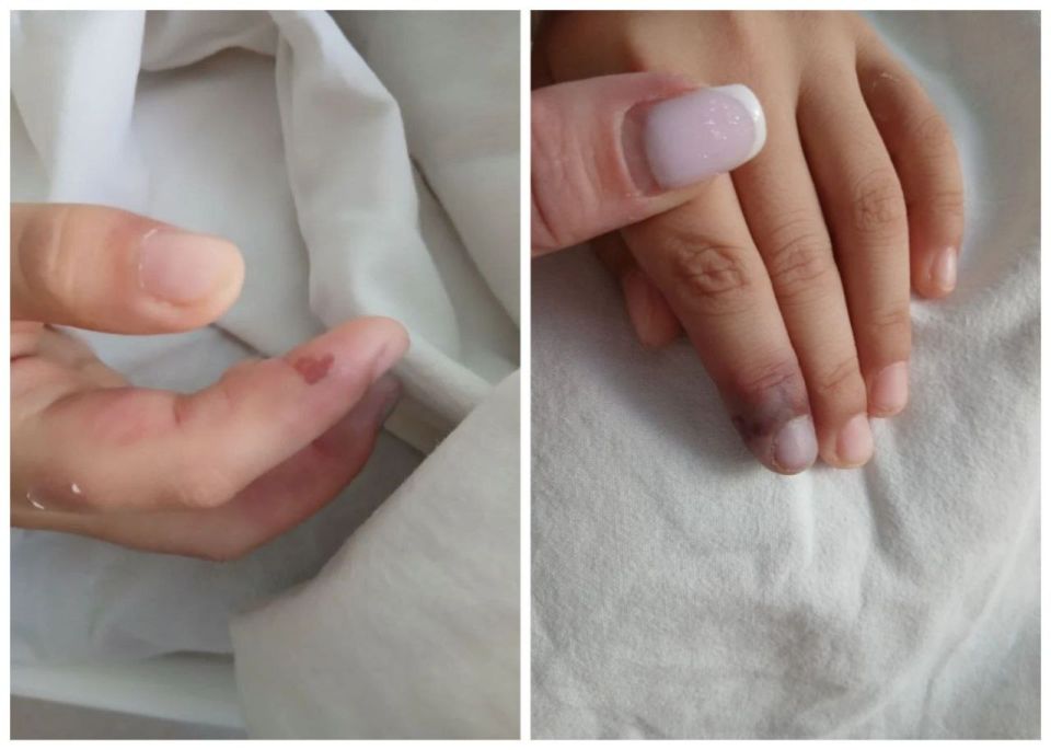 В Саратове врачи спасли девочку со смертельной редкой болезнью