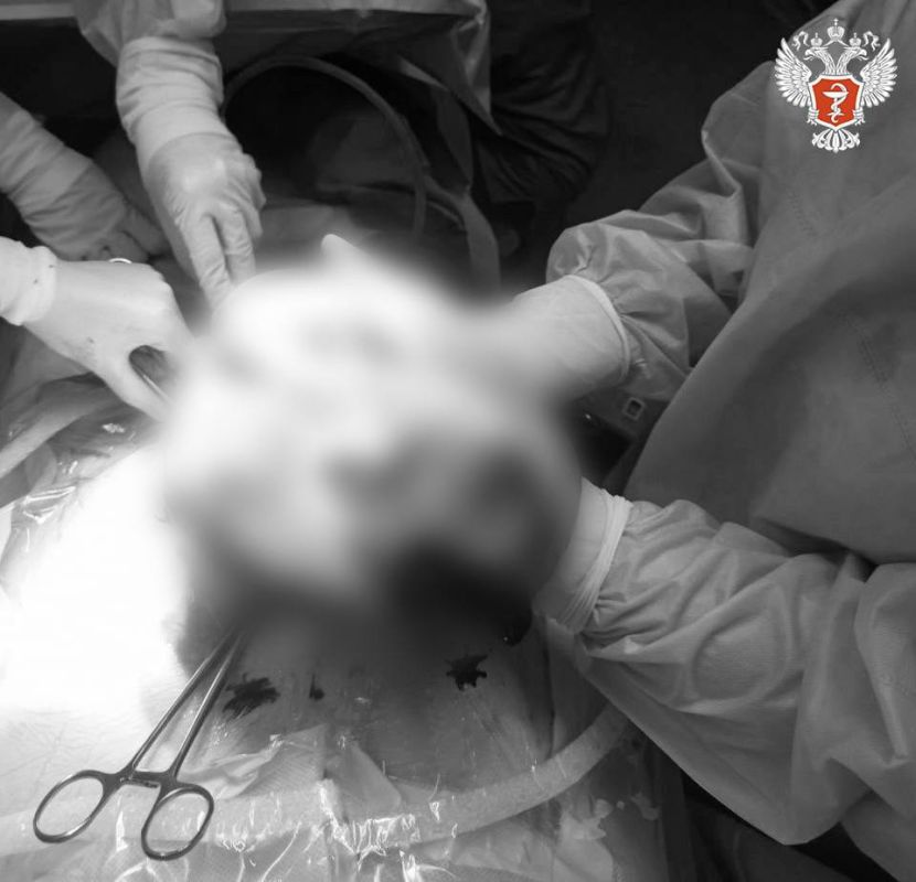 Врачи Калининградской области удалили объемную кисту 13-летней пациентке