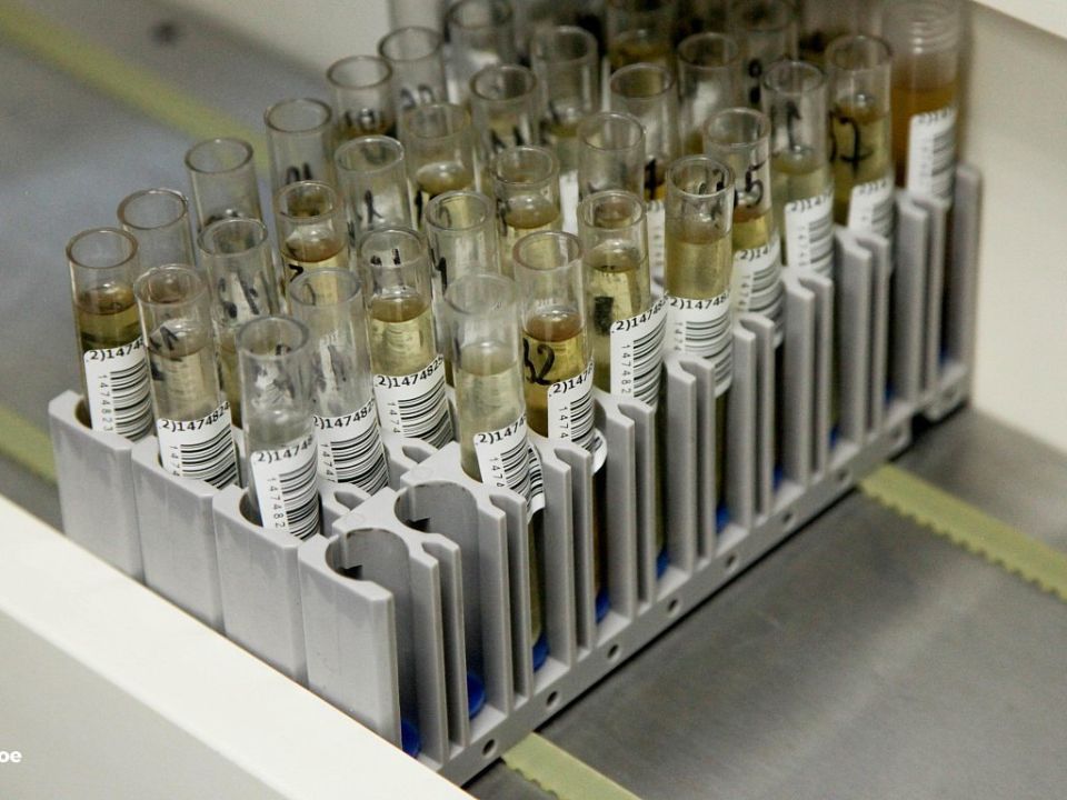 Анализ на ВПЧ для женщин Челябинской области стал бесплатным