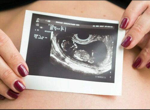 Одобрена выплата пособия по беременности для пяти тысяч студенток