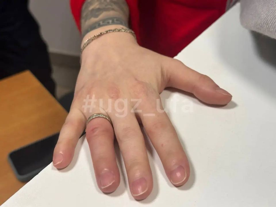 Спасатели помогли беременной уфимке снять кольца