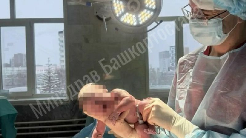 В Уфе женщина с удвоением матки родила здорового малыша