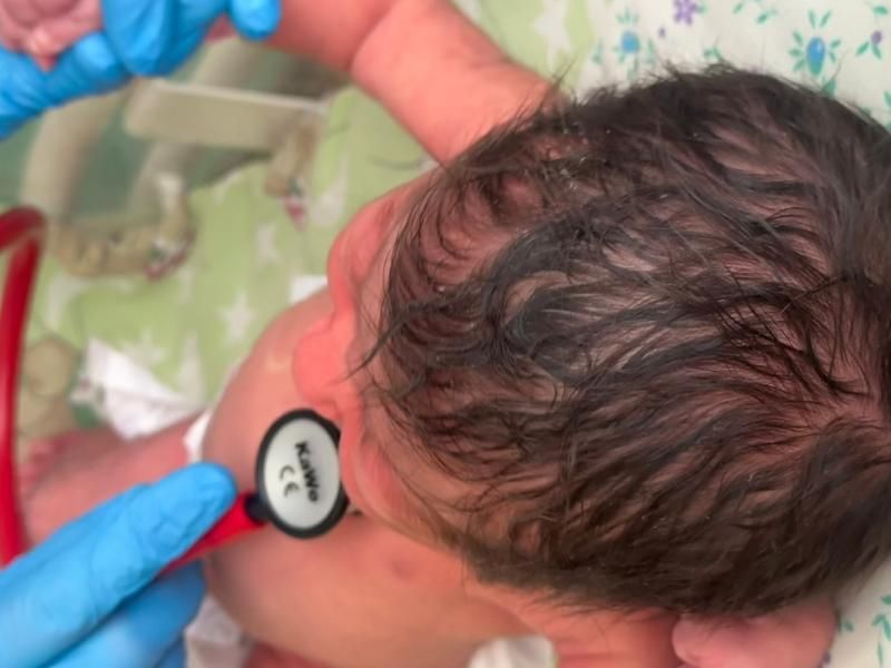 В Рязанском перинатальном центре родилась девочка из тазового предлежания