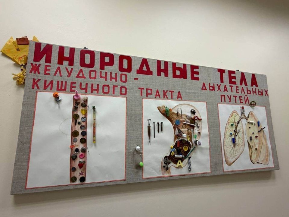 Детская больница Вологды показала коллекцию предметов, извлечённых из ЖКТ маленьких пациентов