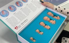 В Кетовской школе у подростков формируют ответственное отношение к будущей семье и рождению детей