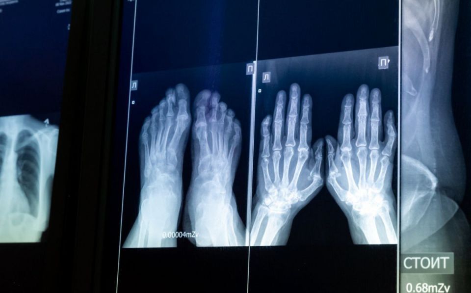 Детская больница Челябинска получила новый цифровой рентген-аппарат