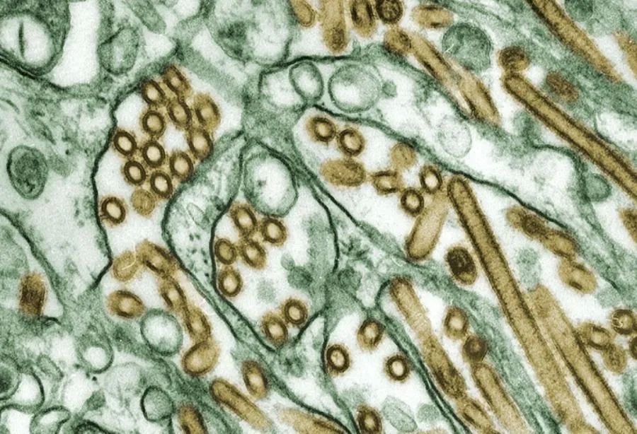 На здоровье! Иркутские ученые нашли в Байкале целебный микроорганизм